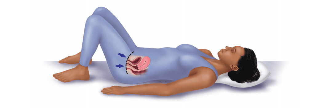 Understanding Pelvic Floor Stimulators: A Modern Approach to Pelvic Health and Muscle Rehabilitation