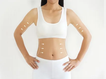 Non-Invasive Body Sculpting: A Modern Approach to Body Contouring